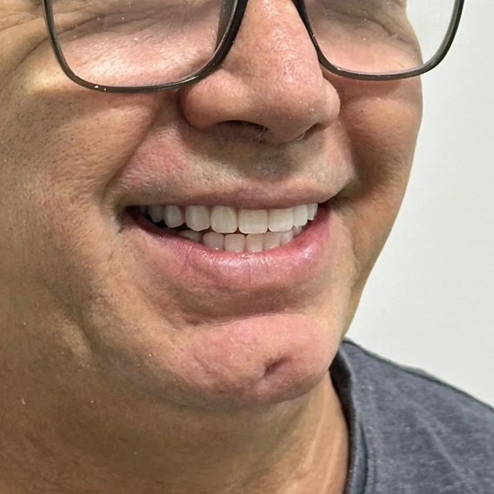 Depois do tratamento — Caso 1