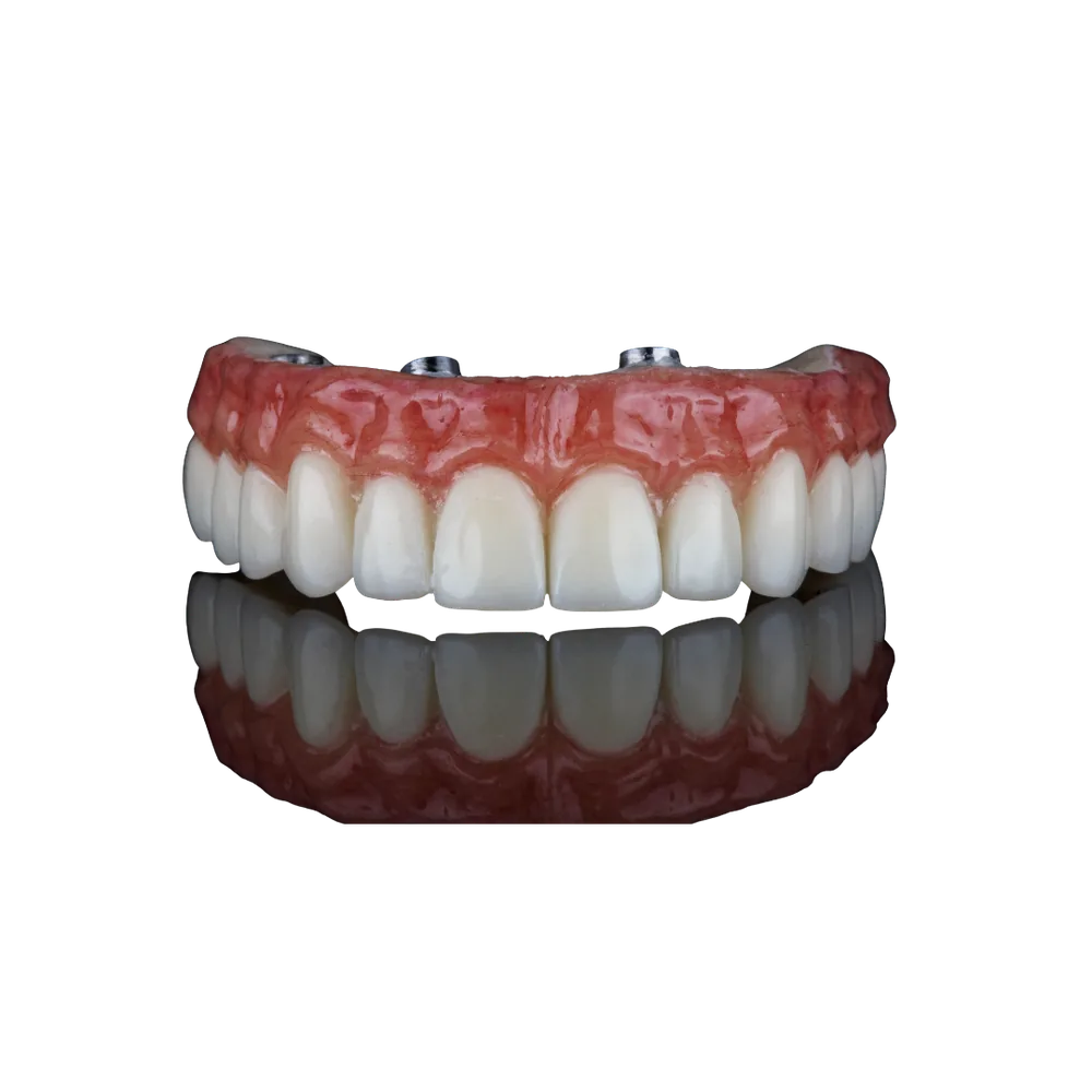 Prótese fixa completa com dentes naturais e acabamento em gengiva